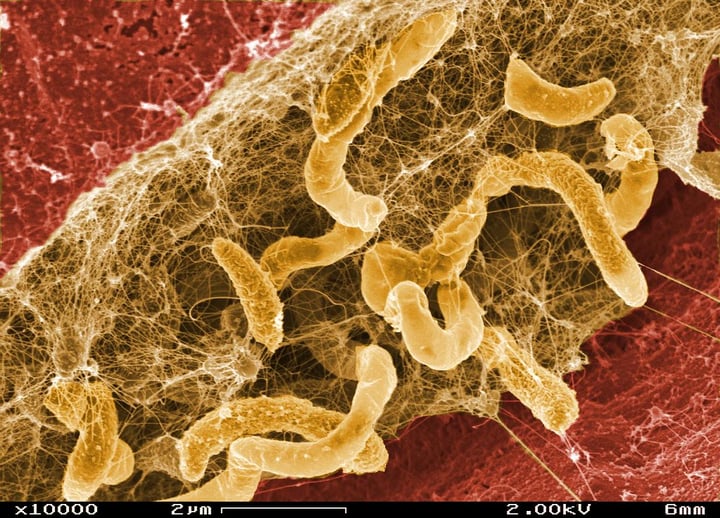 Biofilm dangers